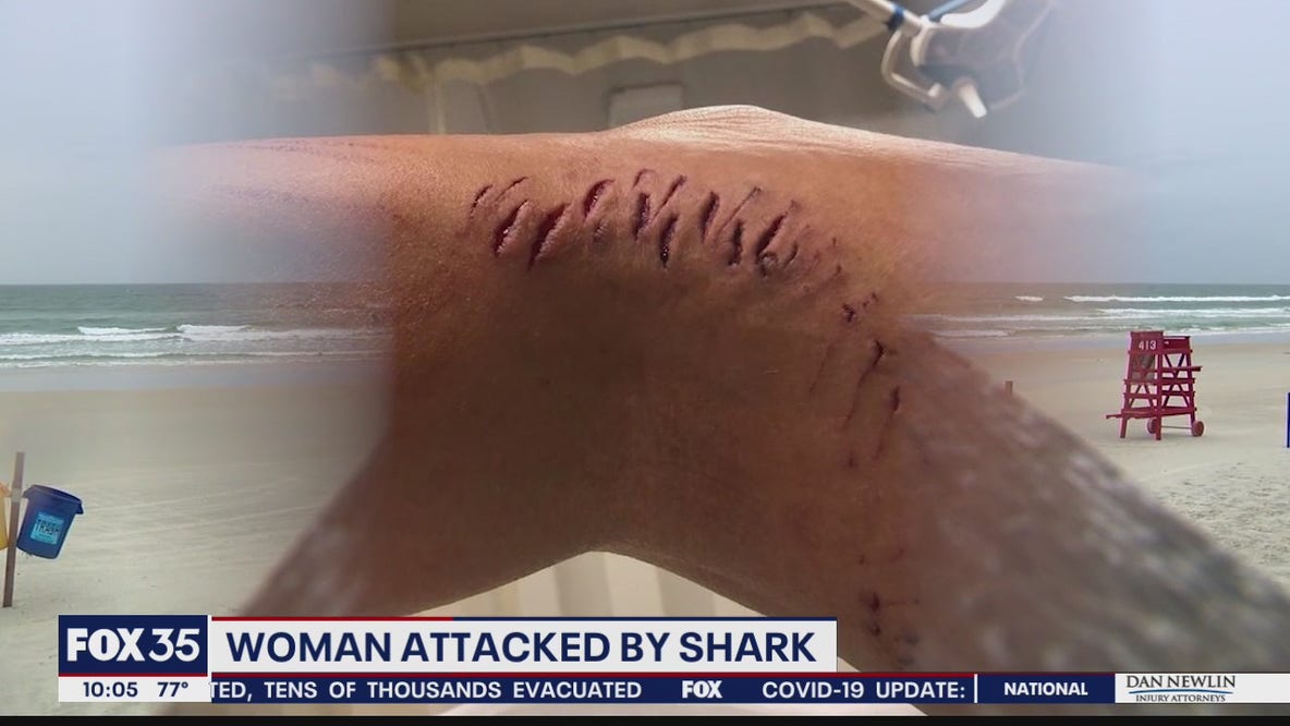 Woman bitten by shark in New Smyrna Beach speaks to FOX 35
